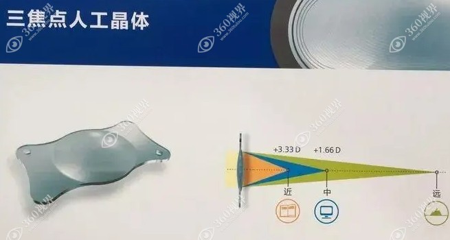 蔡司全视觉三焦点人工晶体怎么样