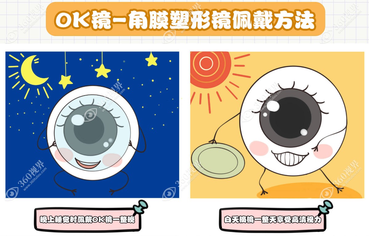戴8年角膜塑形镜的体会和感受