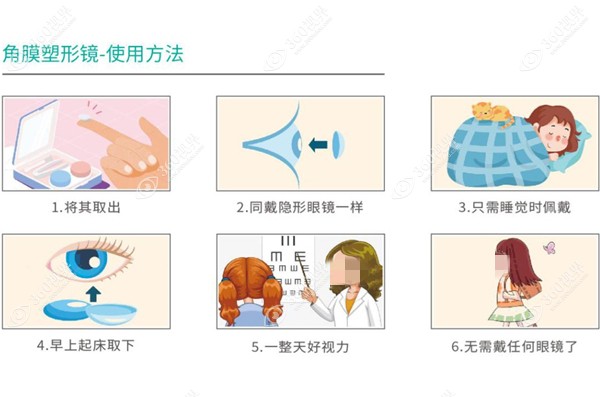 角膜塑形镜的佩戴步骤