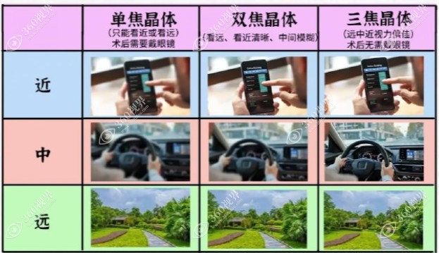 不同焦点人工晶体术后解决恢复范围不同