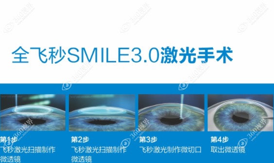 成都普瑞眼科医院周继容怎么挂号www.360tulou.com