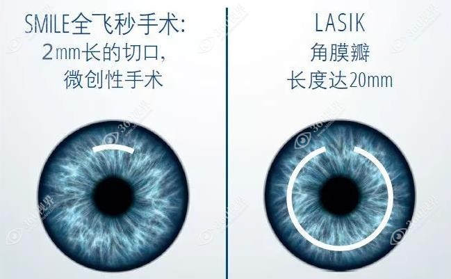 苏州明基医院眼科汪俊医生怎么样