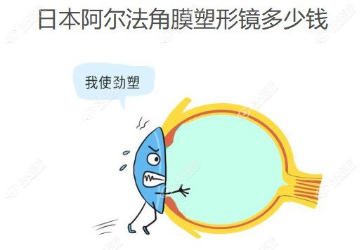 阿尔法角膜塑形镜多少钱