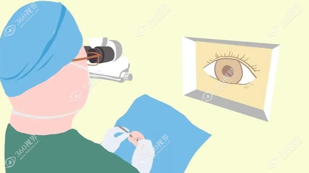 全激光近视眼手术可以报考警校