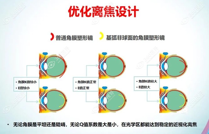 普诺瞳塑形镜多少钱一副