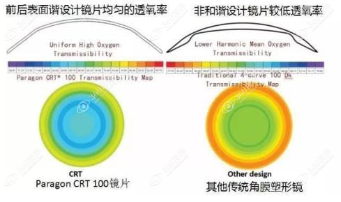 美国crt角膜塑形镜怎么样