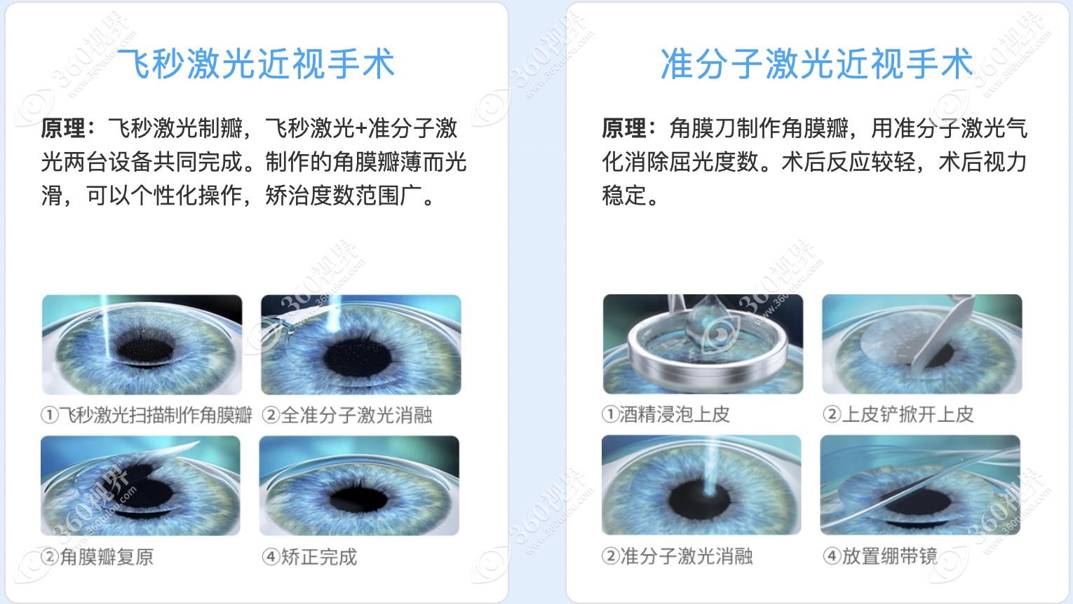 丽水华厦眼科医院近视眼手术价格便宜-360视界