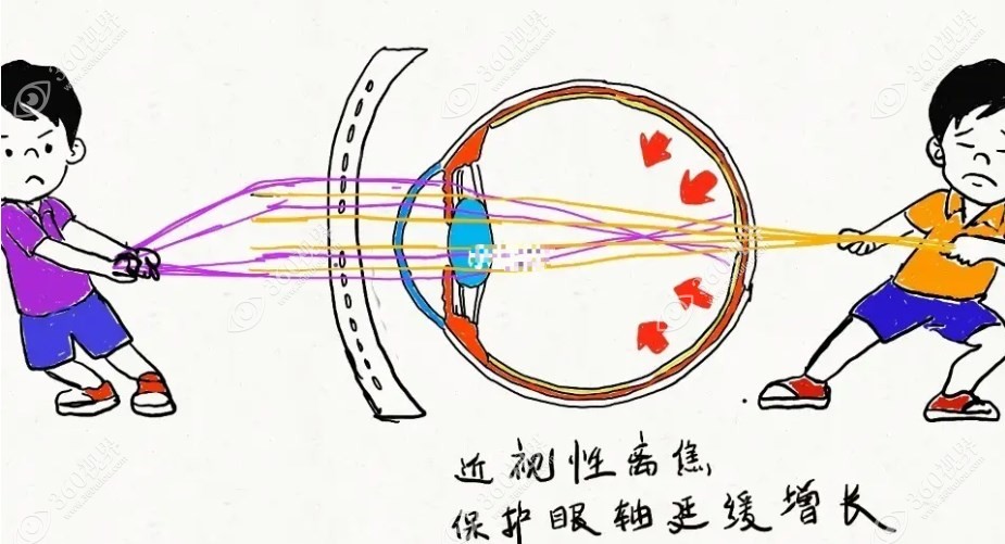 儿童离焦镜片哪些品牌好?www.360tulou.com