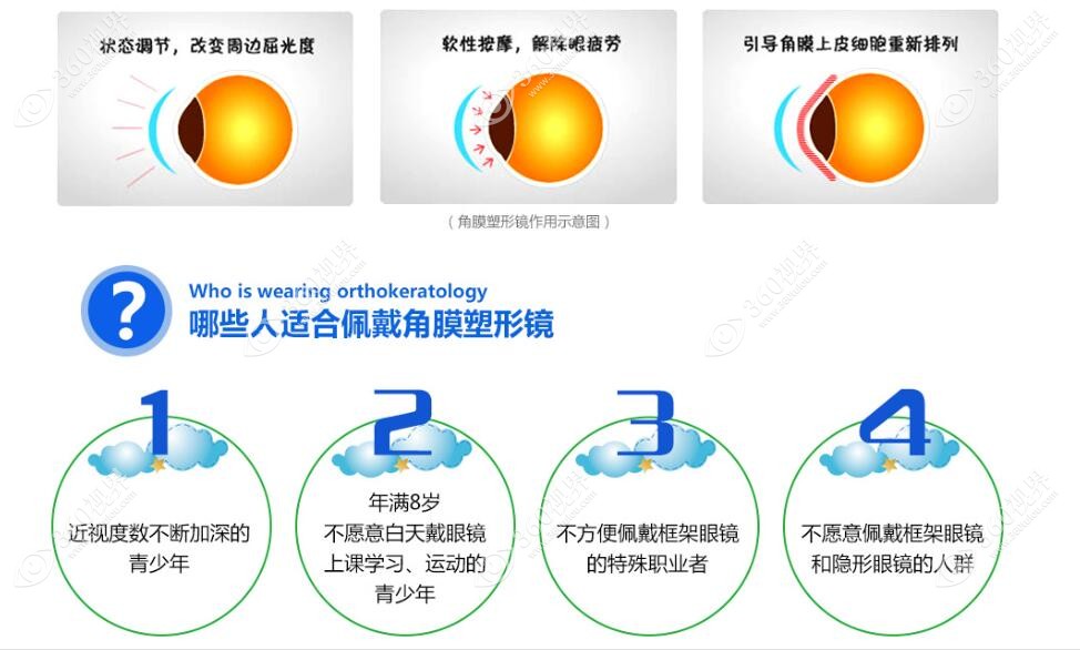 欧几里德角膜塑形镜怎么样