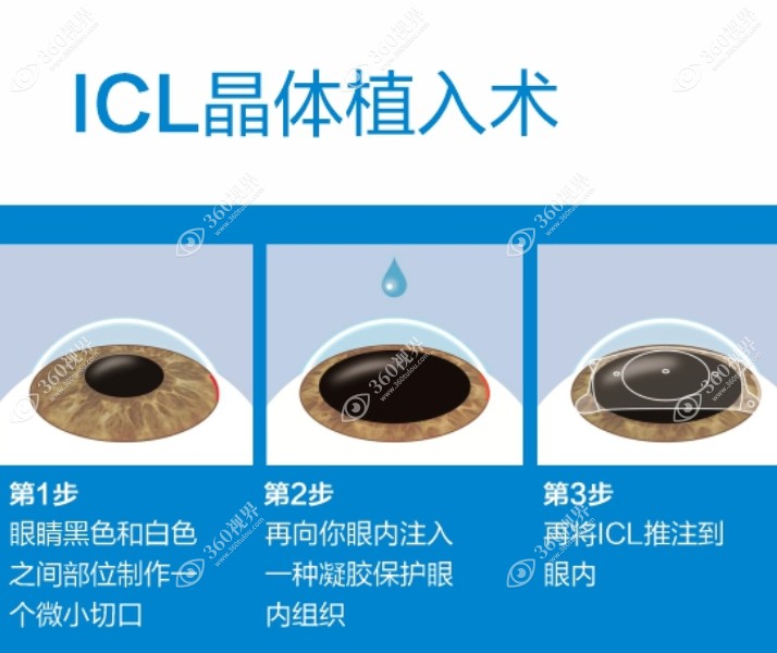 熊雯医生个人优势