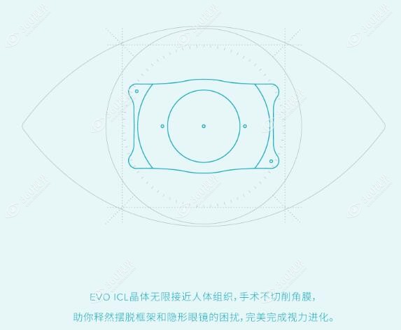 icl晶体植入术可以终身使用360tulou.com