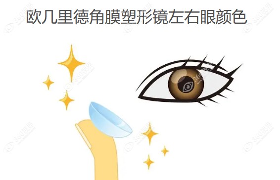 欧几里德角膜塑形镜左右眼颜色