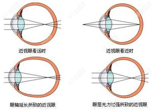 成都瞳仁视康眼科医院开展的眼科项目