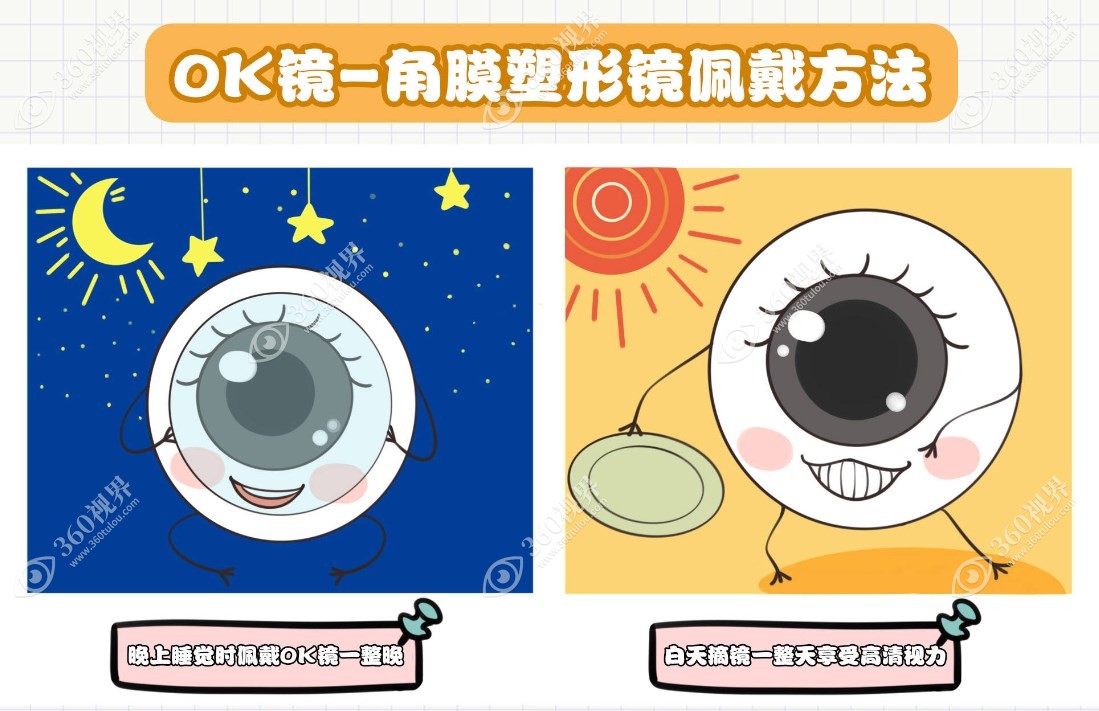 角膜塑形镜