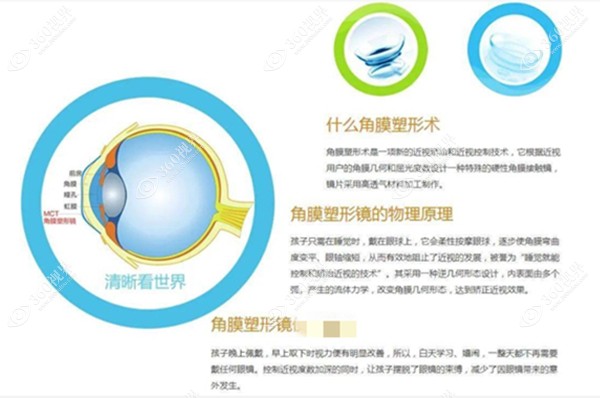 角膜塑形镜的原理www.360tulou.com