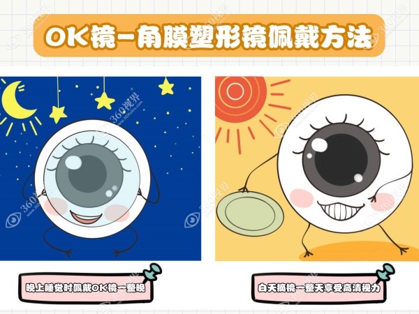 离焦软镜和ok镜（角膜塑形镜）区别在于佩戴时间不同