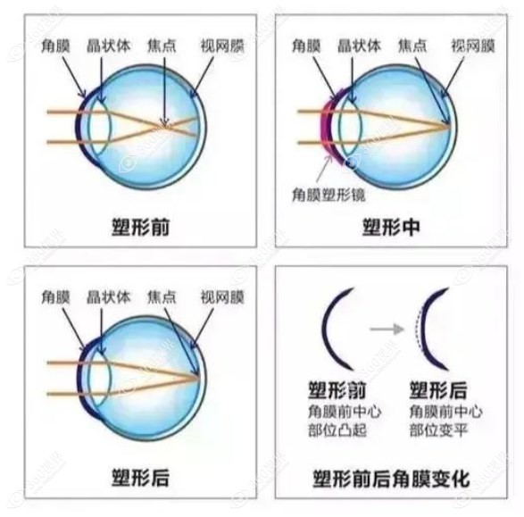 OK镜的作用