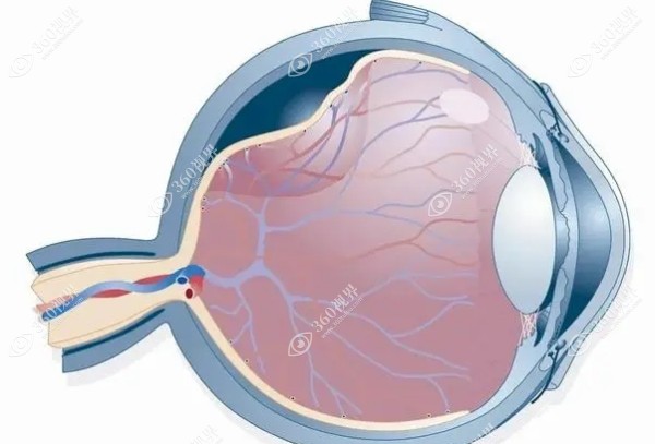 视网膜脱落手术费用大概多少钱?单眼视网膜脱离术价格3000起