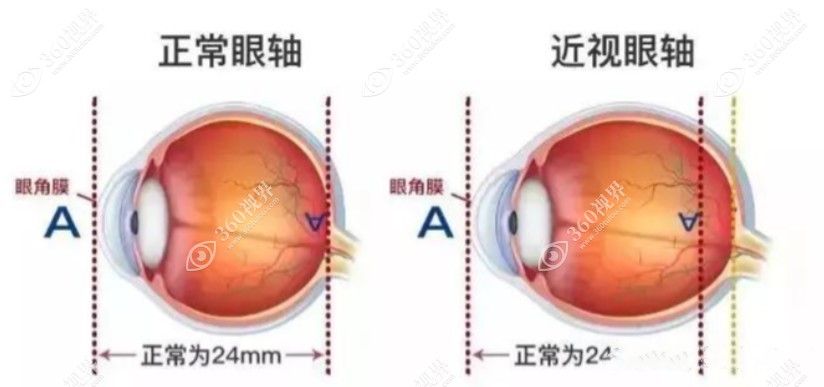 郑州大学第一附属医院眼科开展项目