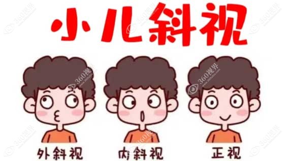 儿童斜视检查项目及流程