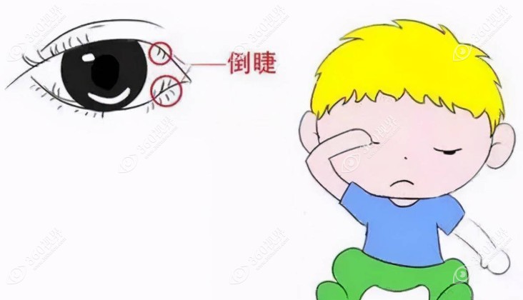 孩子频繁眨眼的六种原因360tulou.com