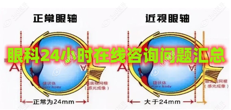 眼科问题汇总回答