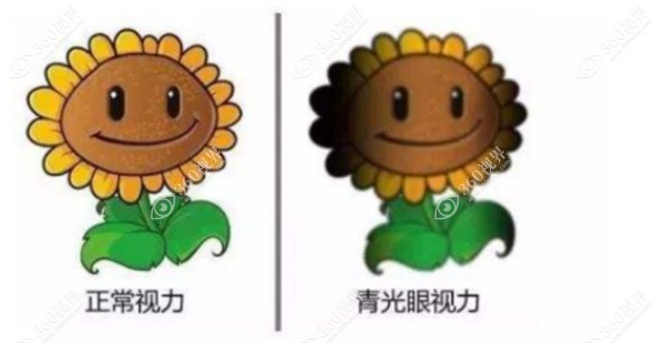 青光眼的早期症状6个表现