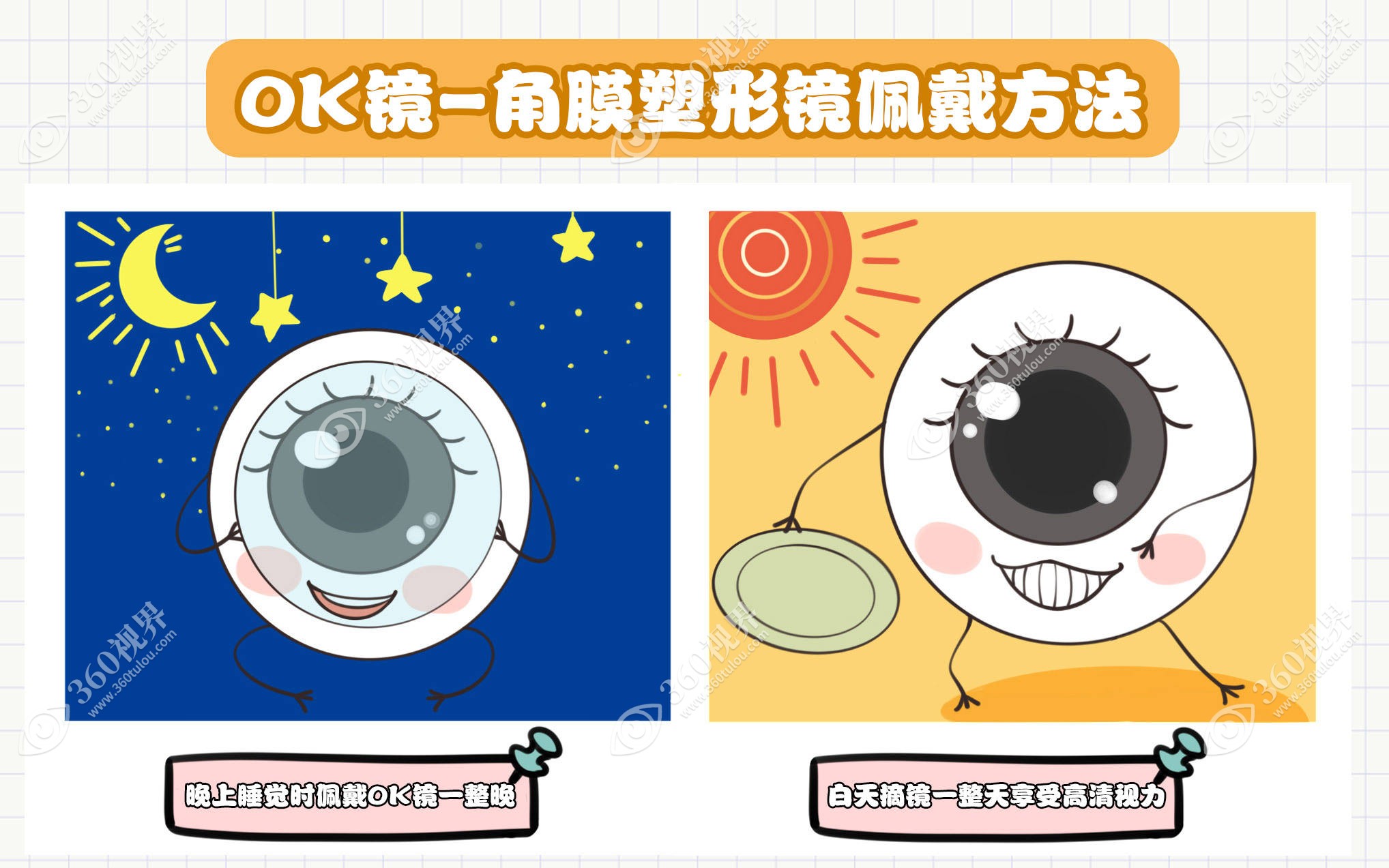 儿童近视戴ok镜既能延缓视力增加也不影响日常活动