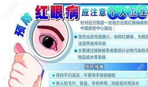 预防红眼病