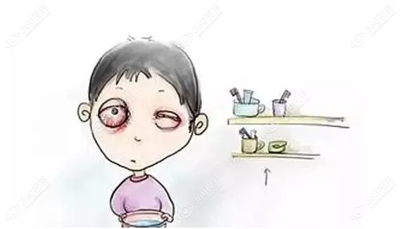 红眼病该怎么治疗