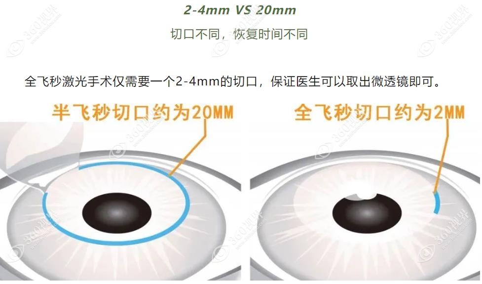 半飞秒和全飞秒切开对比360tulou.com