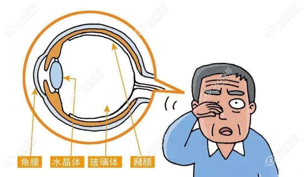 近视眼内部情况360tulou.com