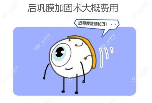 后巩膜加固术大概费用