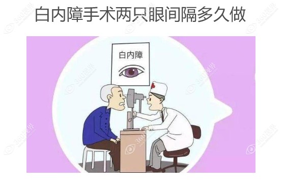 白内障手术两只眼间隔多久做