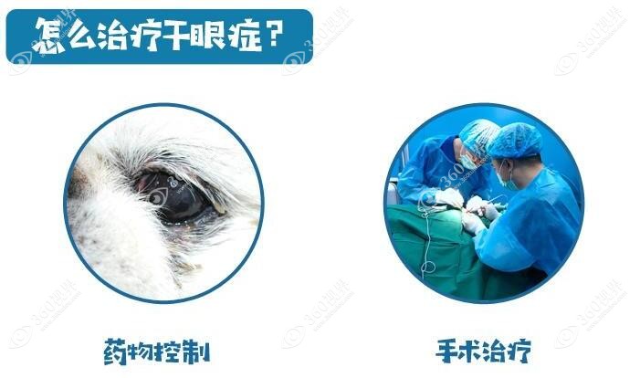 各眼科医院干眼症手术费用分享-360视界网