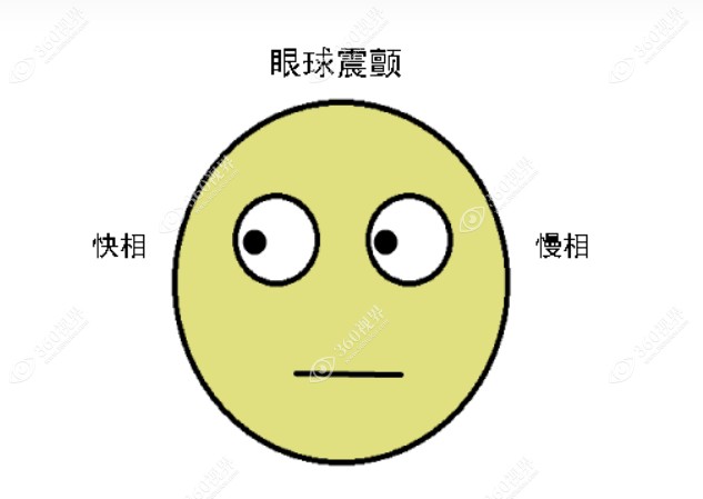 先天性眼球震颤多大可以做手术