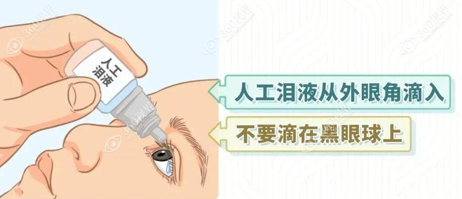 人工泪液干眼症治疗价格100元起