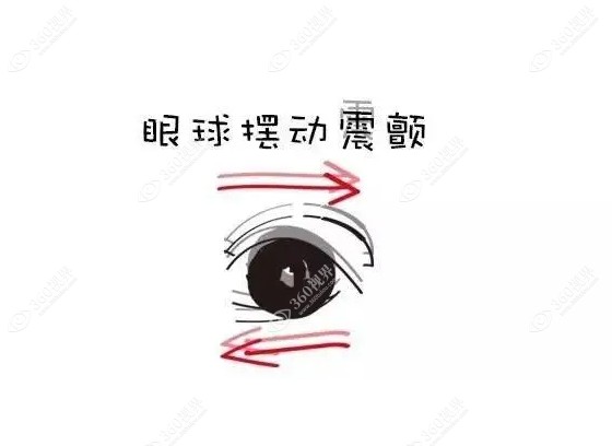 先天性眼球震颤多大可以做手术www.360tulou.com