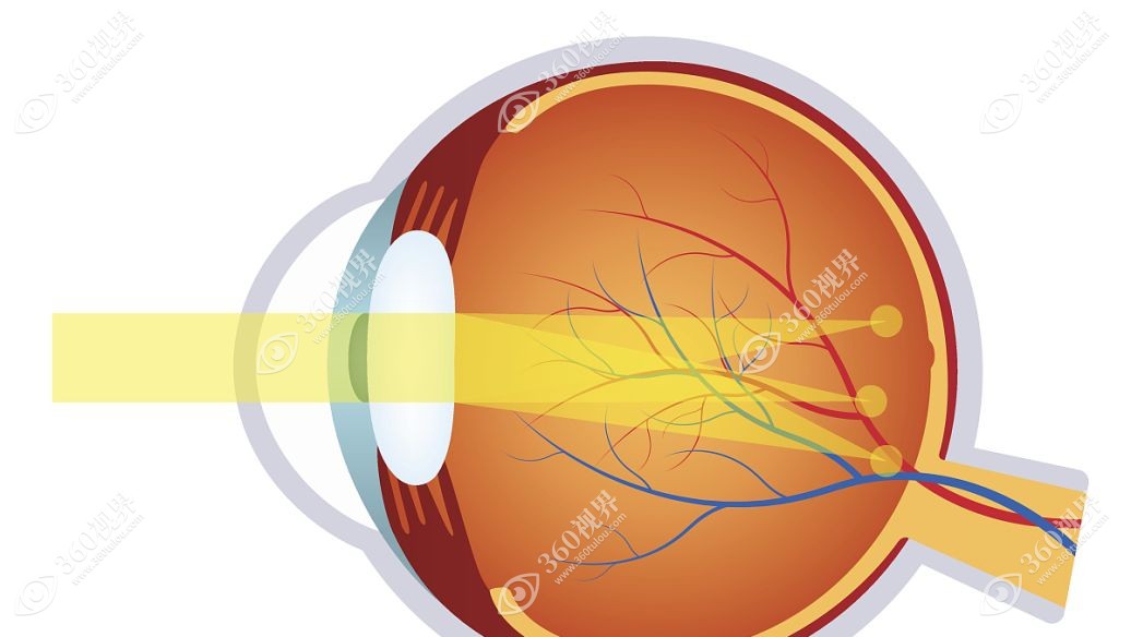 圆锥角膜是一种非炎症性的眼病www.360tulou.com