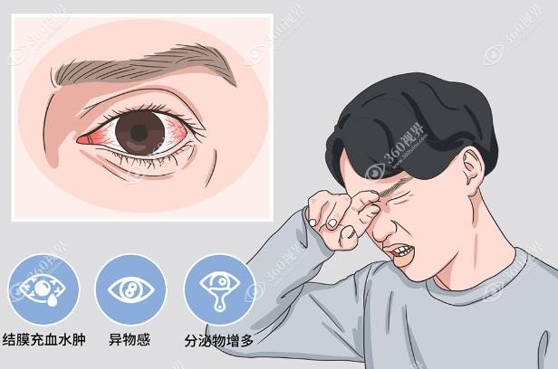 非感染性因素