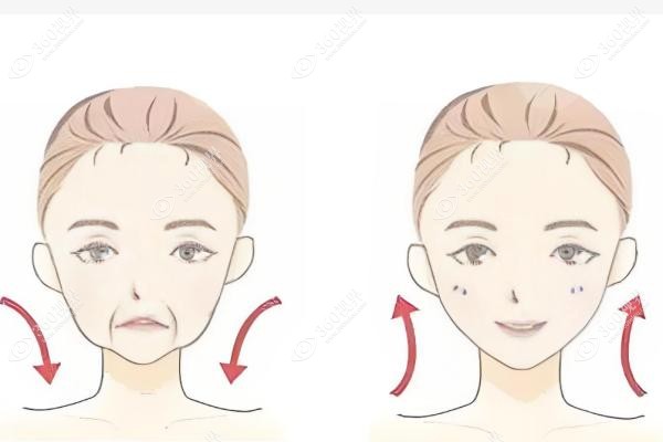 颌面整形手术价格.jpg