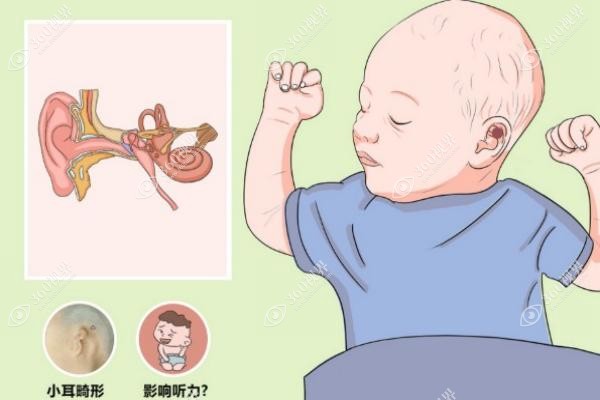 孩子的耳朵畸形有免费治疗的政策吗