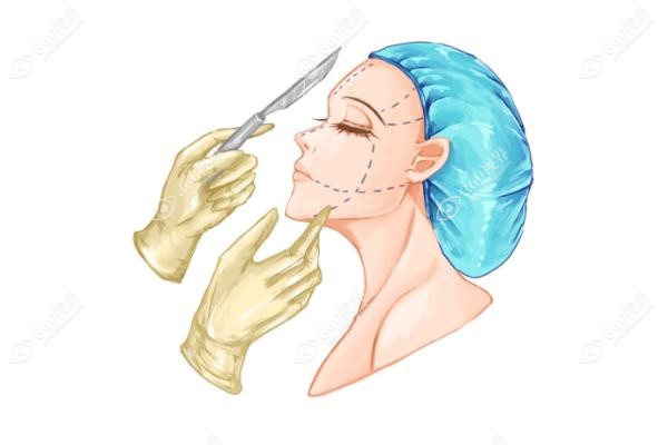 下颌角截骨手术多少钱.jpg