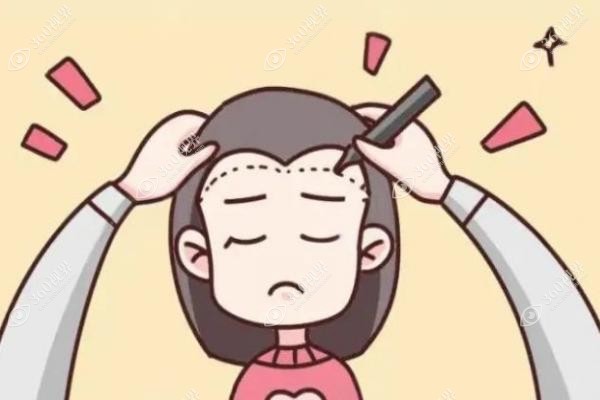 厦门万禾丽生植发医院植发技术怎么样