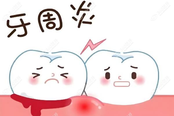 家属回应网友关心韦神牙齿问题