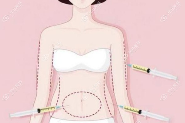 人鱼体雕.jpg