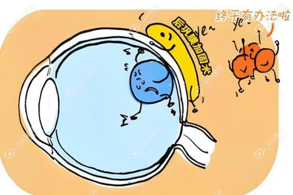 褚仁远现在还做手术吗？亲自主刀后巩膜加固术,附挂号方式及出诊医院2