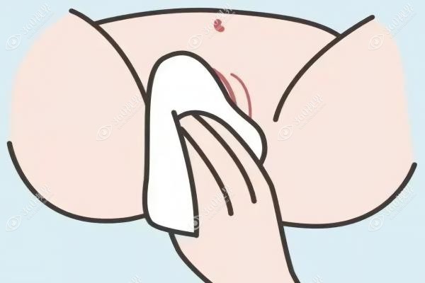蝴蝶型馒头型哪个常见