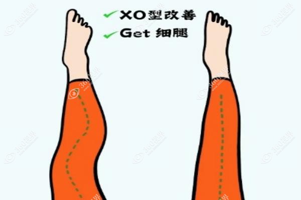 国内直腿术医院推荐排名