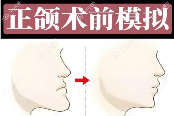 广州广大正颌整形口碑